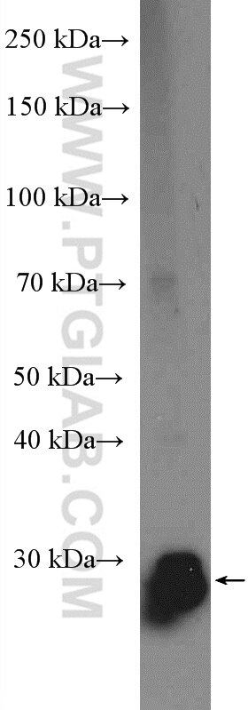 Western Blot (WB) analysis of mouse kidney tissue using BPHL Polyclonal antibody (17974-1-AP)