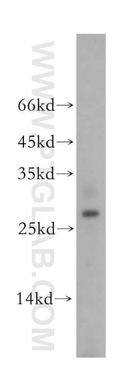 Western Blot (WB) analysis of human kidney tissue using BPHL Polyclonal antibody (17974-1-AP)