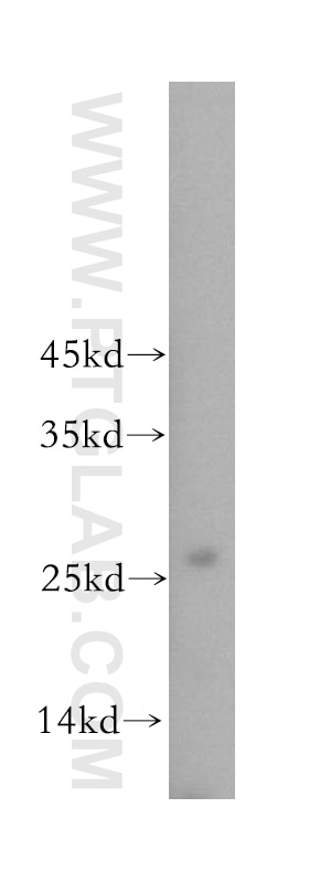 Western Blot (WB) analysis of human liver tissue using BPHL Polyclonal antibody (17974-1-AP)