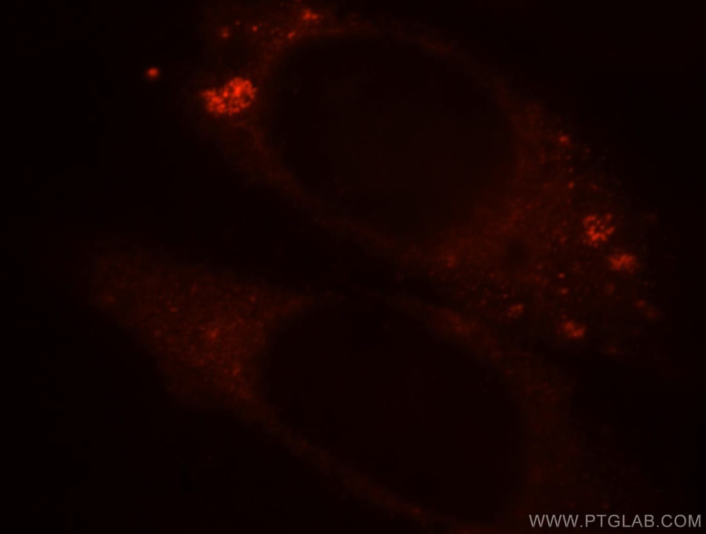 Immunofluorescence (IF) / fluorescent staining of HepG2 cells using BPI Polyclonal antibody (14368-1-AP)