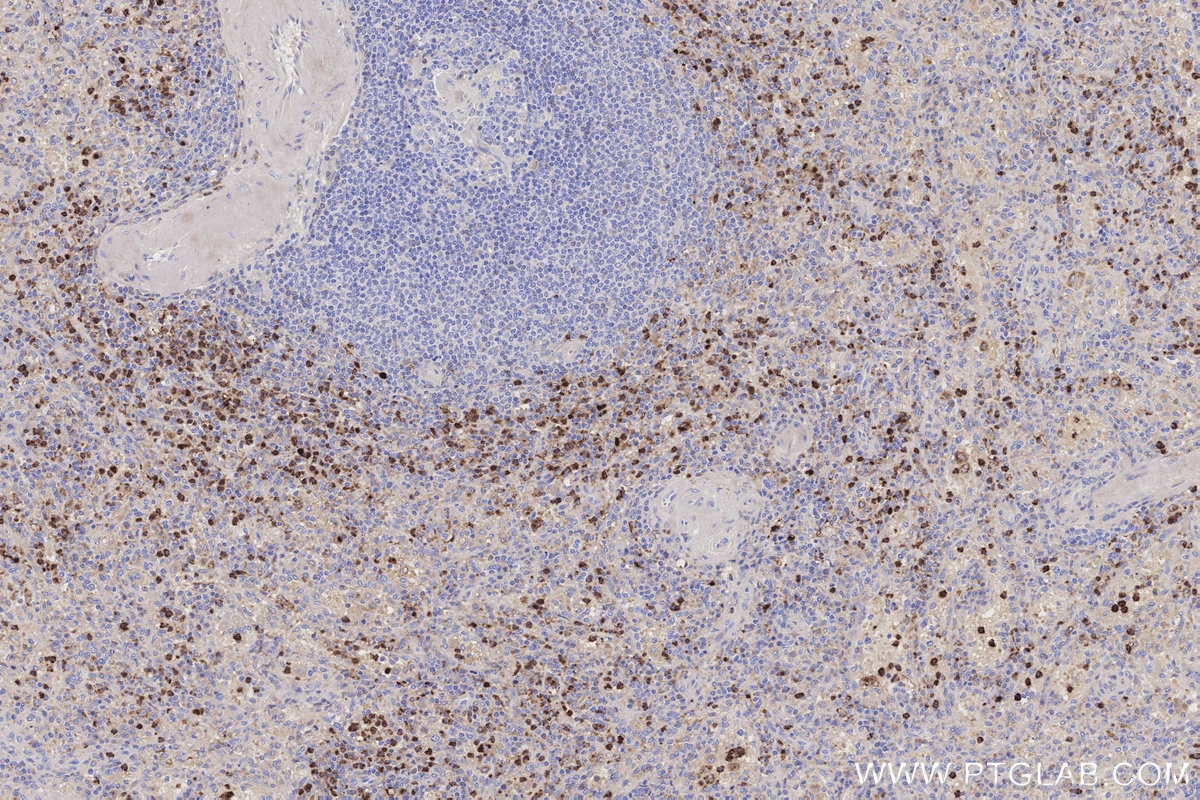 Immunohistochemistry (IHC) staining of human spleen tissue using BPI Polyclonal antibody (14368-1-AP)