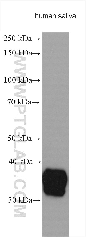 Western Blot (WB) analysis of various lysates using BPIFA2 Polyclonal antibody (28293-1-AP)