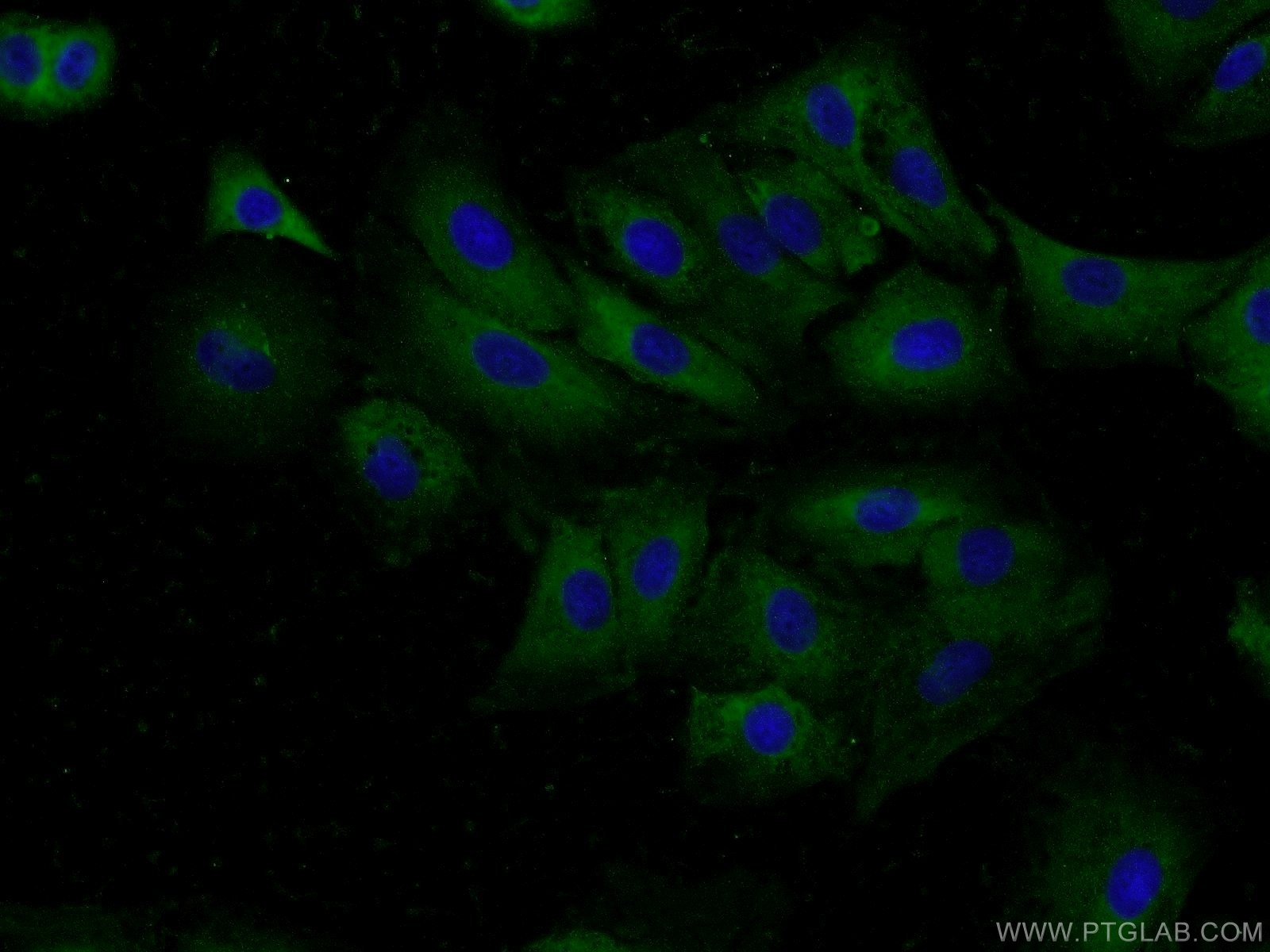 Immunofluorescence (IF) / fluorescent staining of A549 cells using BPIL1 Polyclonal antibody (13461-2-AP)