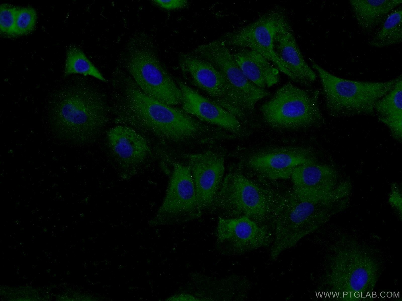 IF Staining of A549 using 13461-2-AP