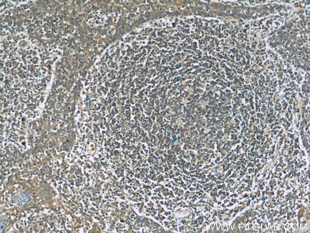 Immunohistochemistry (IHC) staining of human tonsillitis tissue using BPIL1 Polyclonal antibody (13461-2-AP)