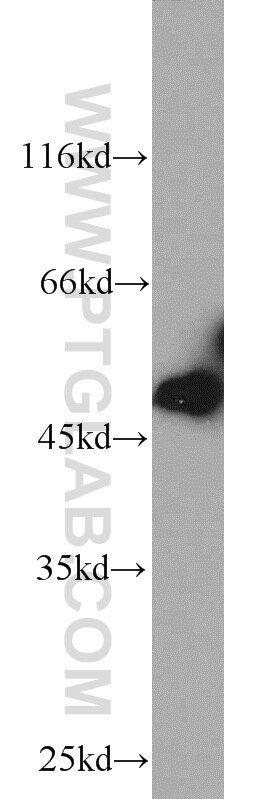 WB analysis of A549 using 13461-2-AP