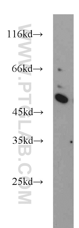 Western Blot (WB) analysis of A549 cells using BPIL1 Polyclonal antibody (13461-2-AP)