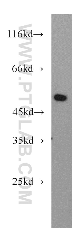 Western Blot (WB) analysis of A549 cells using BPIL1 Polyclonal antibody (13461-2-AP)