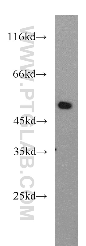 WB analysis of A549 using 13461-2-AP