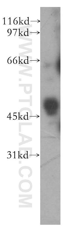 Western Blot (WB) analysis of A549 cells using BPIL1 Polyclonal antibody (13461-2-AP)