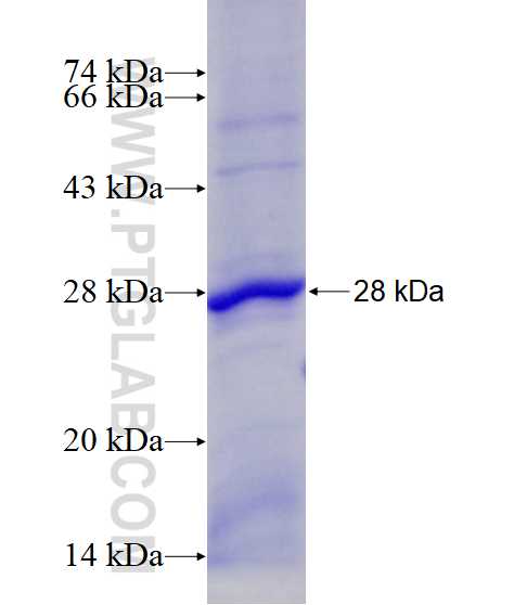 BPIL2 fusion protein Ag19073 SDS-PAGE