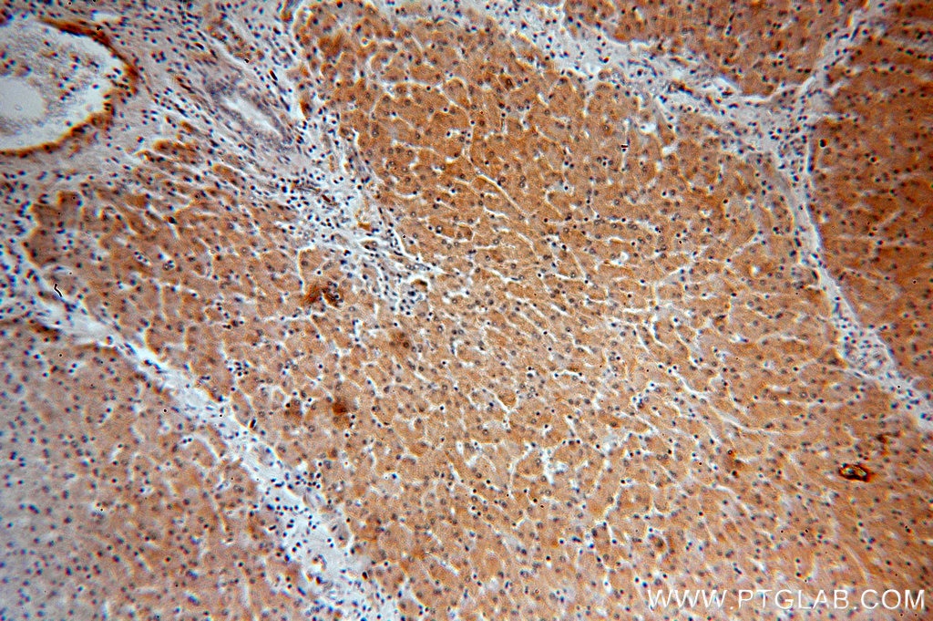 Immunohistochemistry (IHC) staining of human liver tissue using BPNT1 Polyclonal antibody (16461-1-AP)