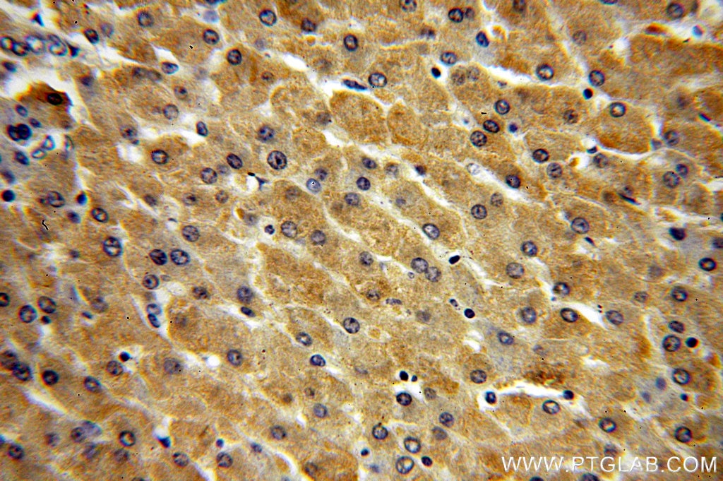 IHC staining of human liver using 16461-1-AP