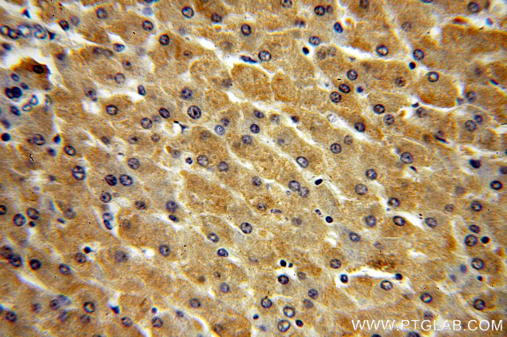 Immunohistochemistry (IHC) staining of human liver tissue using BPNT1 Polyclonal antibody (16461-1-AP)