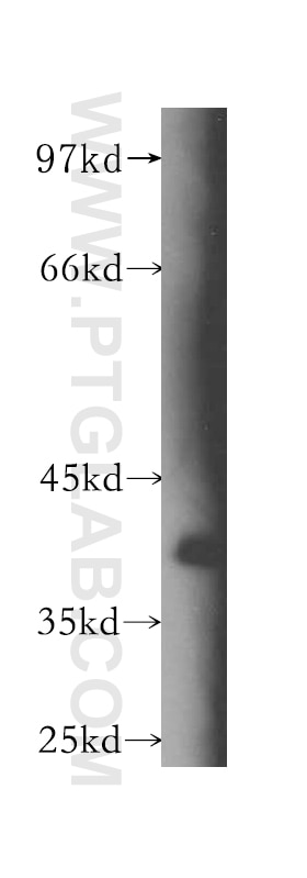 Western Blot (WB) analysis of human kidney tissue using BPNT1 Polyclonal antibody (16461-1-AP)