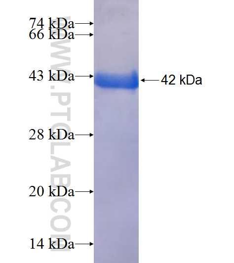BPNT1 fusion protein Ag9701 SDS-PAGE