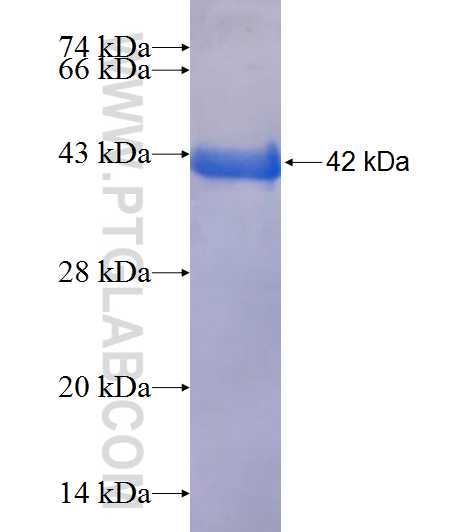 BPNT1 fusion protein Ag9701 SDS-PAGE