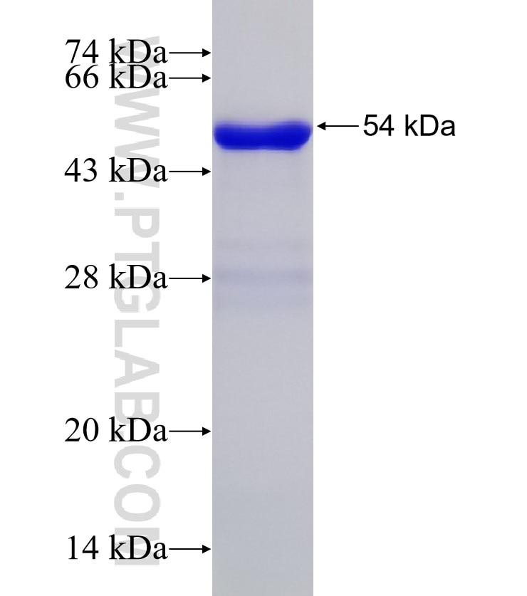 BPTF fusion protein Ag27761 SDS-PAGE