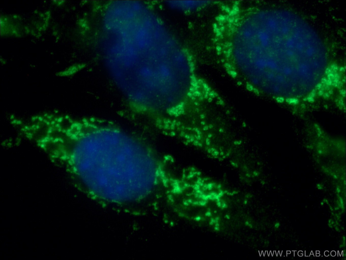 Immunofluorescence (IF) / fluorescent staining of NIH/3T3 cells using BRAF Polyclonal antibody (20899-1-AP)