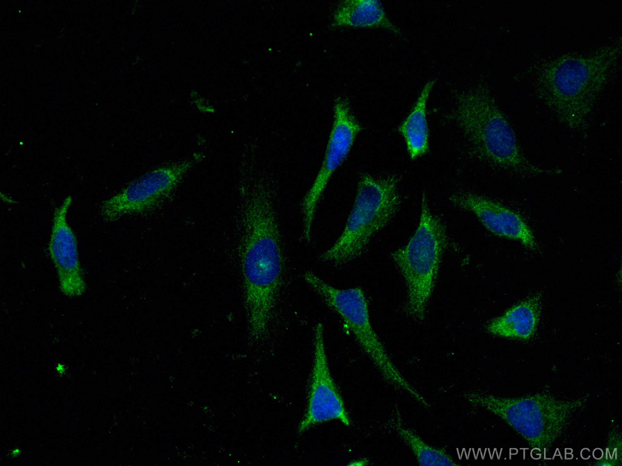 Immunofluorescence (IF) / fluorescent staining of HeLa cells using BRAF Polyclonal antibody (20899-1-AP)