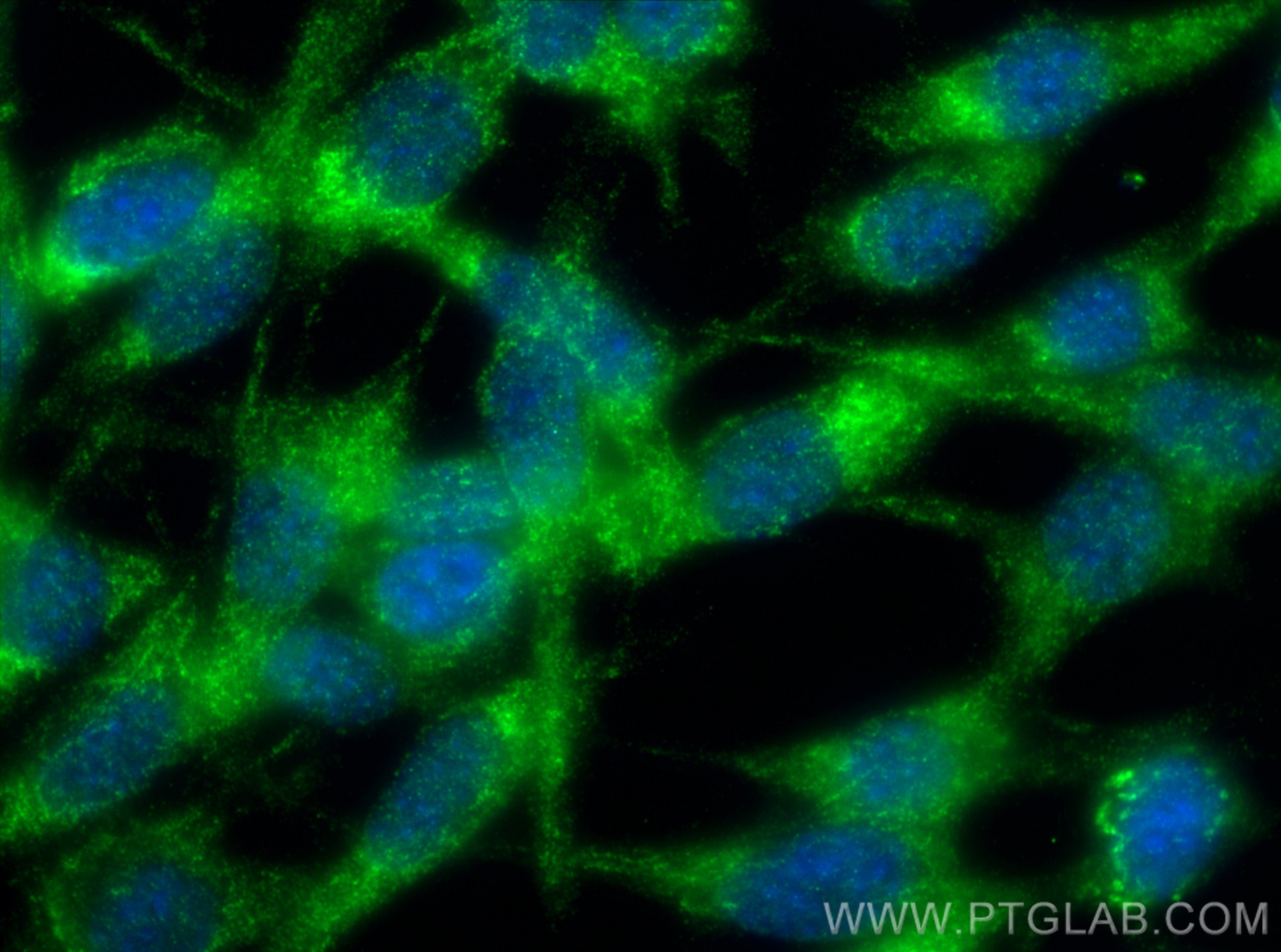 Immunofluorescence (IF) / fluorescent staining of NIH/3T3 cells using BRAF Polyclonal antibody (20899-1-AP)