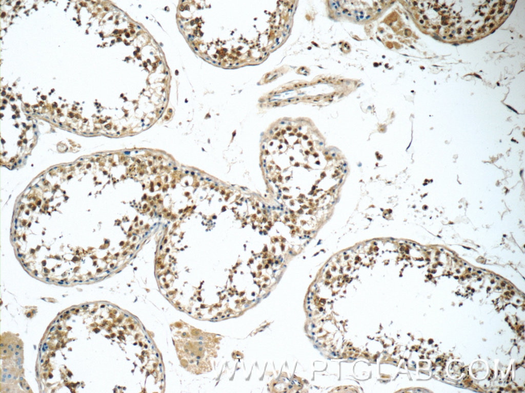 Immunohistochemistry (IHC) staining of human testis tissue using BRAF Polyclonal antibody (20899-1-AP)