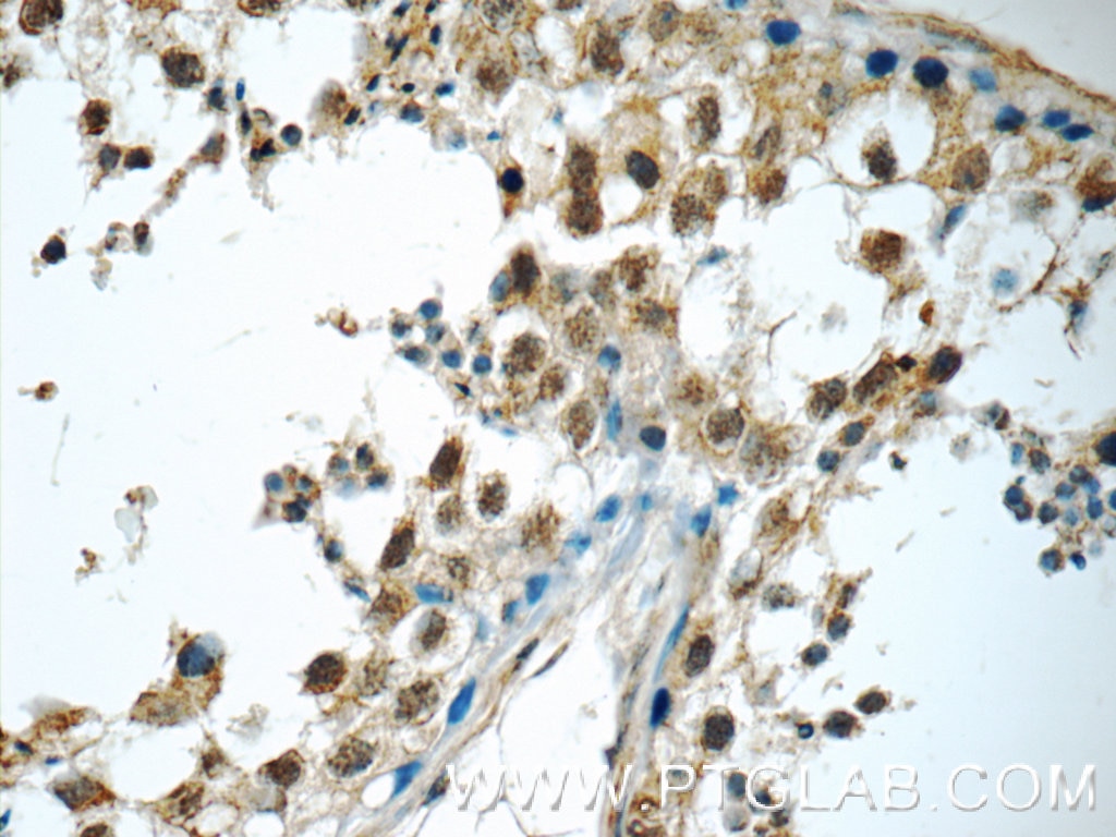 Immunohistochemistry (IHC) staining of human testis tissue using BRAF Polyclonal antibody (20899-1-AP)