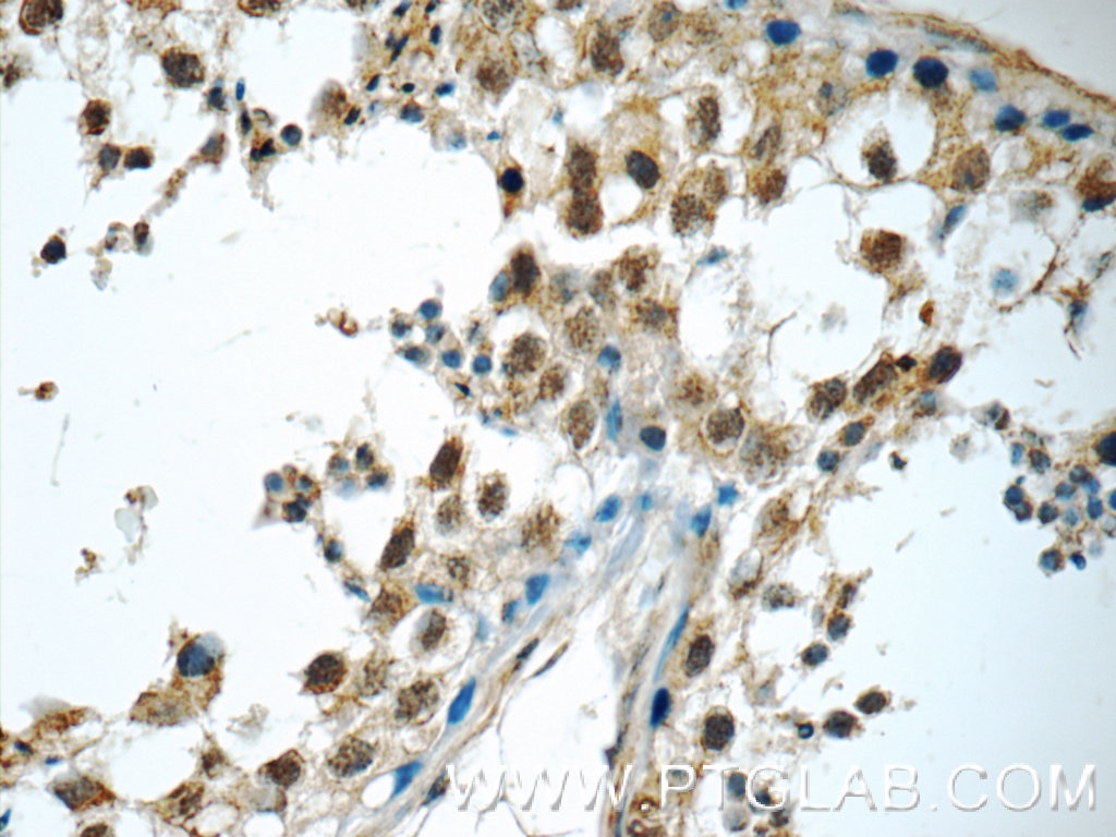 IHC staining of human testis using 20899-1-AP