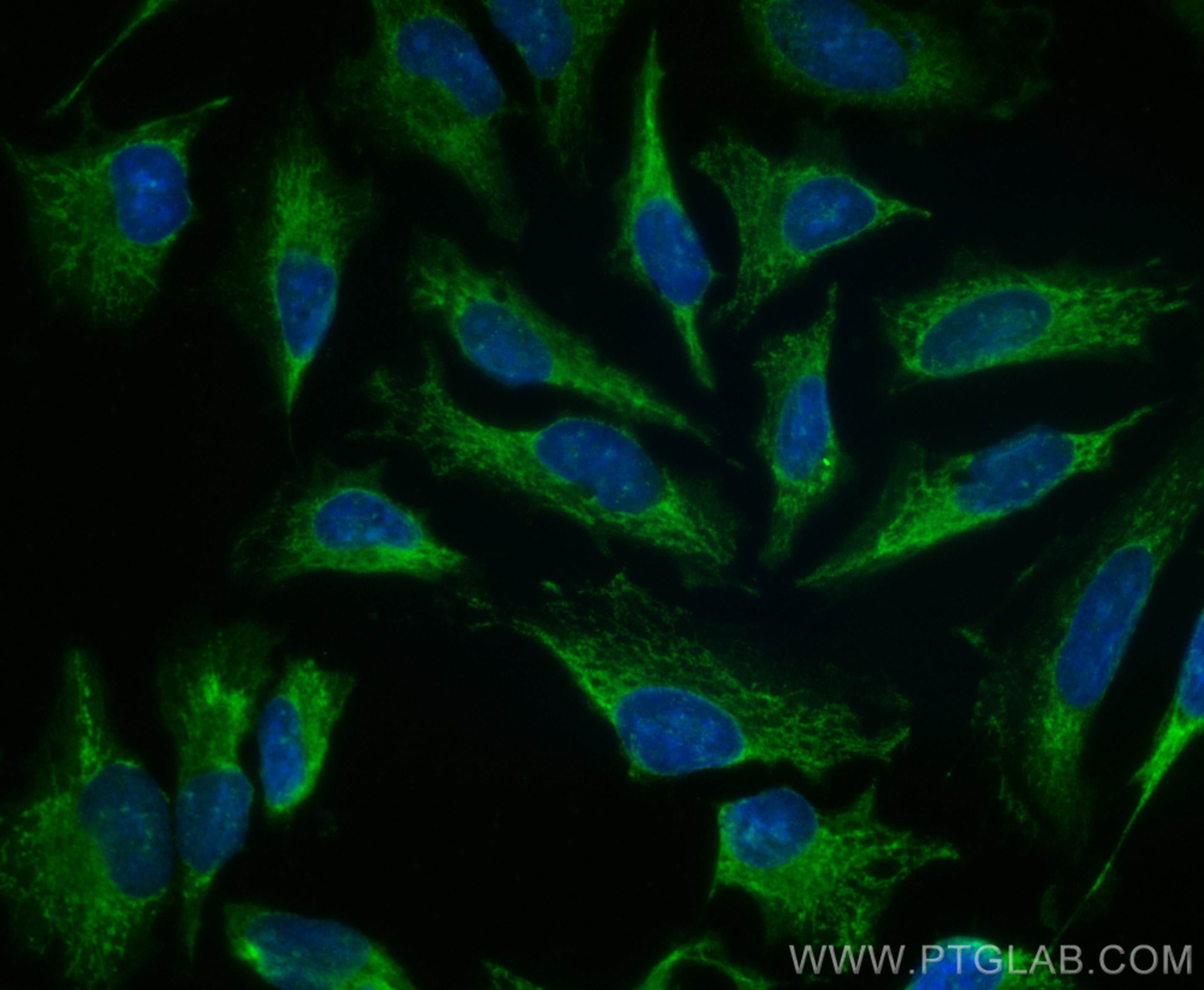 Immunofluorescence (IF) / fluorescent staining of HeLa cells using CoraLite® Plus 488-conjugated BRAF Polyclonal anti (CL488-20899)