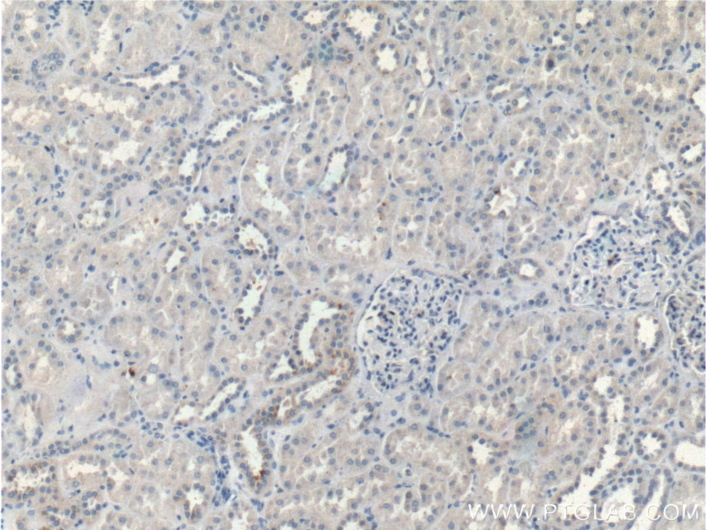 Immunohistochemistry (IHC) staining of human kidney tissue using BRAP Polyclonal antibody (26004-1-AP)