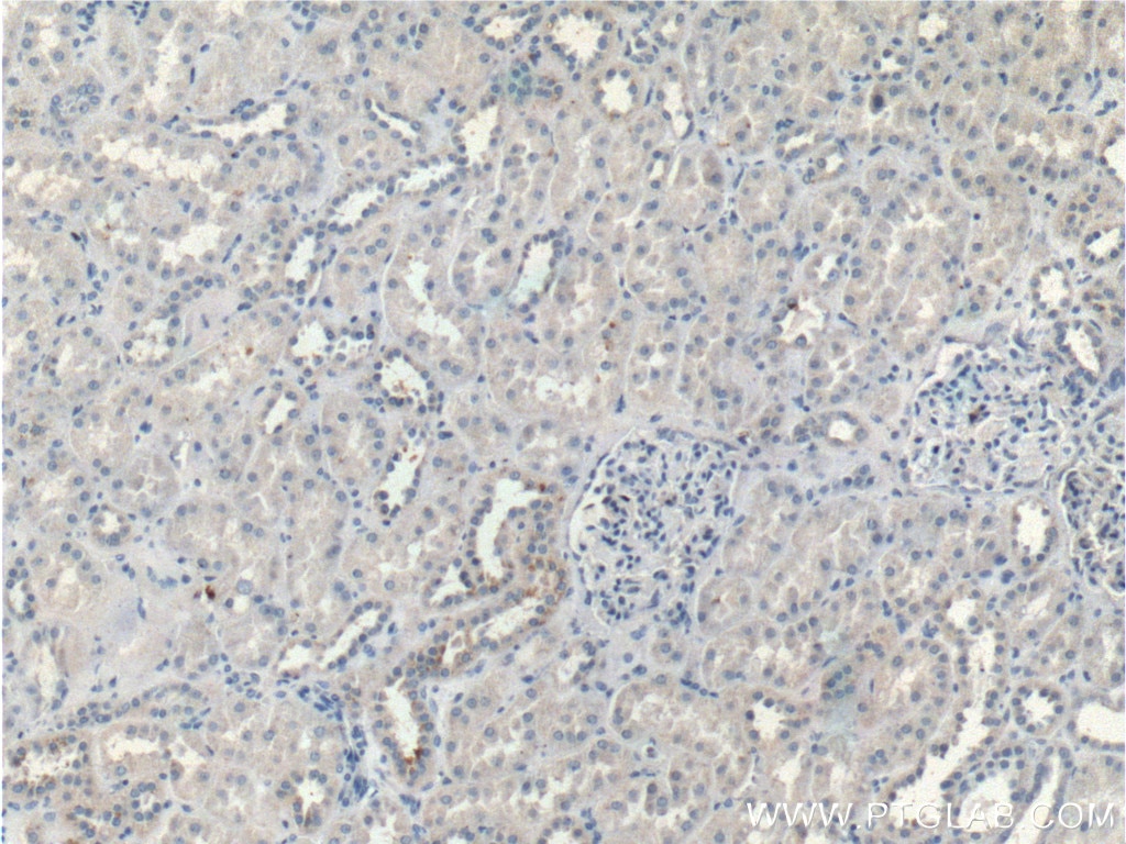 Immunohistochemistry (IHC) staining of human kidney tissue using BRAP Polyclonal antibody (26004-1-AP)