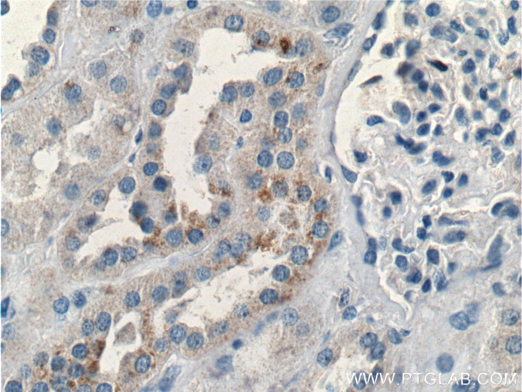 Immunohistochemistry (IHC) staining of human kidney tissue using BRAP Polyclonal antibody (26004-1-AP)