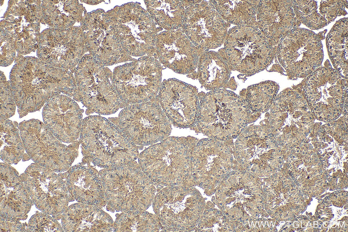 Immunohistochemistry (IHC) staining of mouse testis tissue using BRAP Polyclonal antibody (27431-1-AP)