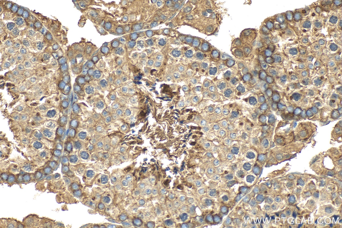 Immunohistochemistry (IHC) staining of mouse testis tissue using BRAP Polyclonal antibody (27431-1-AP)