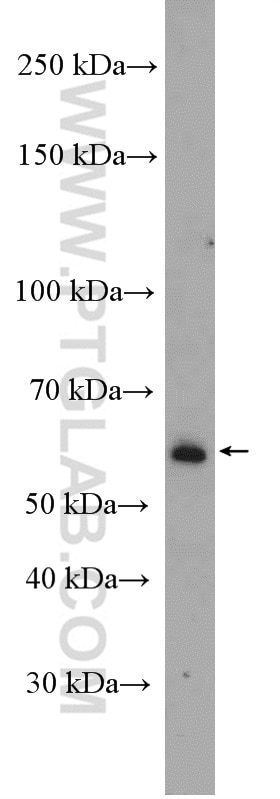 Western Blot (WB) analysis of MCF-7 cells using BRAP Polyclonal antibody (27431-1-AP)