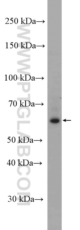 Western Blot (WB) analysis of A431 cells using BRAP Polyclonal antibody (27431-1-AP)