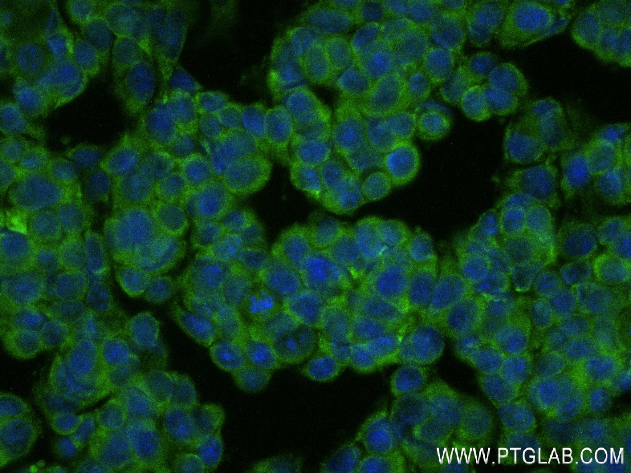 Immunofluorescence (IF) / fluorescent staining of MCF-7 cells using BRAP Recombinant antibody (83314-6-RR)