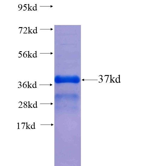 BRAP fusion protein Ag23279 SDS-PAGE