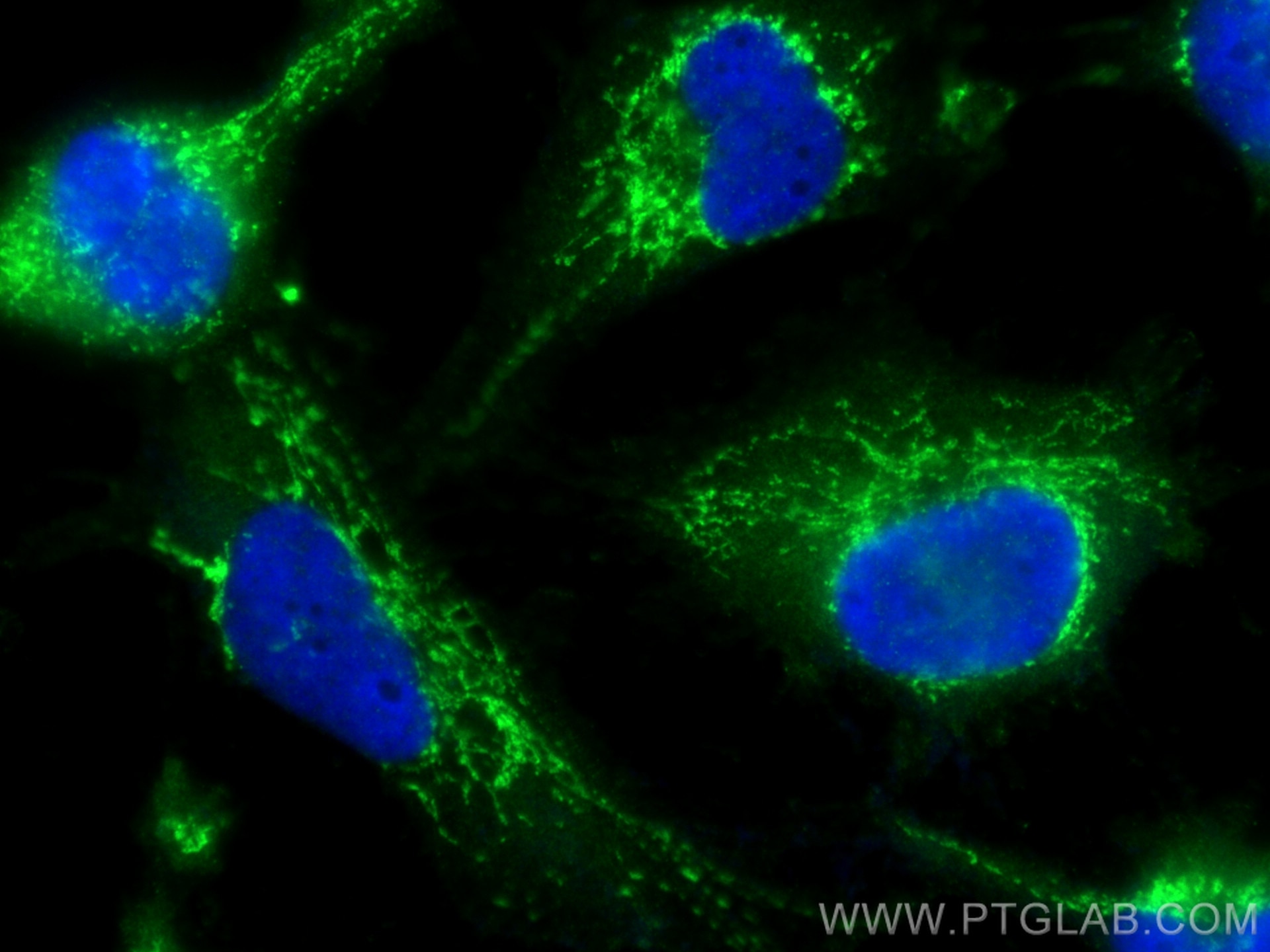 Immunofluorescence (IF) / fluorescent staining of U-251 cells using BRAWNIN Polyclonal antibody (30212-1-AP)