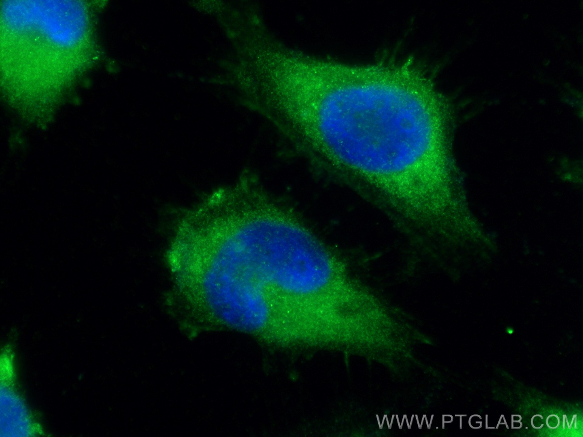 Immunofluorescence (IF) / fluorescent staining of U-251 cells using BRAWNIN Polyclonal antibody (30212-1-AP)