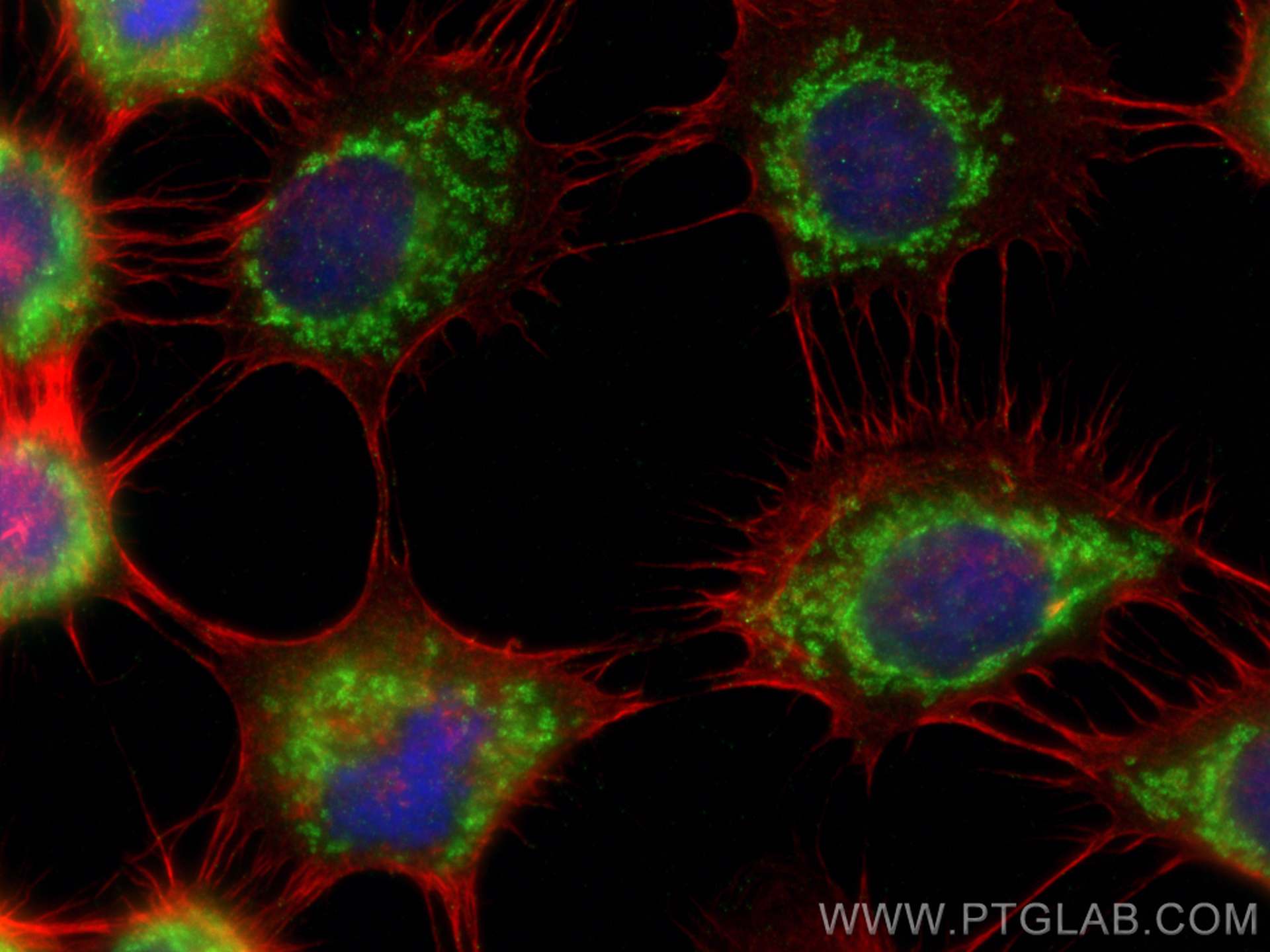 Immunofluorescence (IF) / fluorescent staining of A431 cells using BRAWNIN Polyclonal antibody (30212-1-AP)