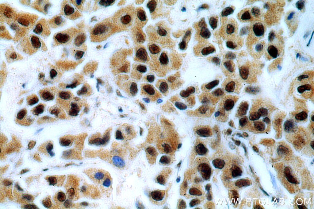 BRCA1 Polyclonal antibody