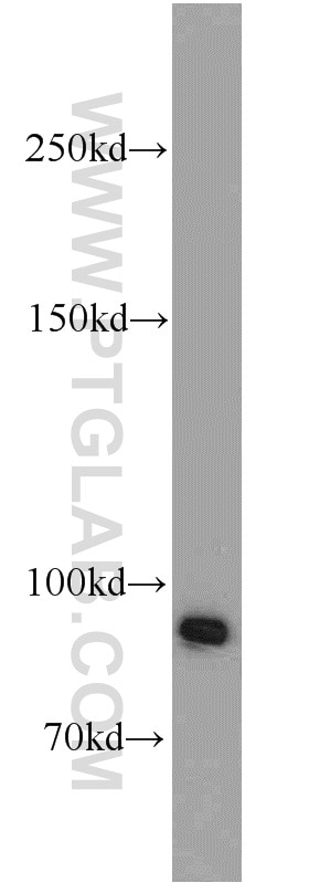 BRCA1 Polyclonal antibody