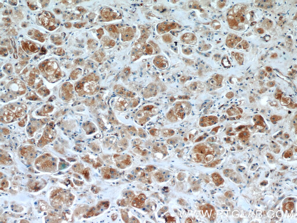 BRCA1 Polyclonal antibody