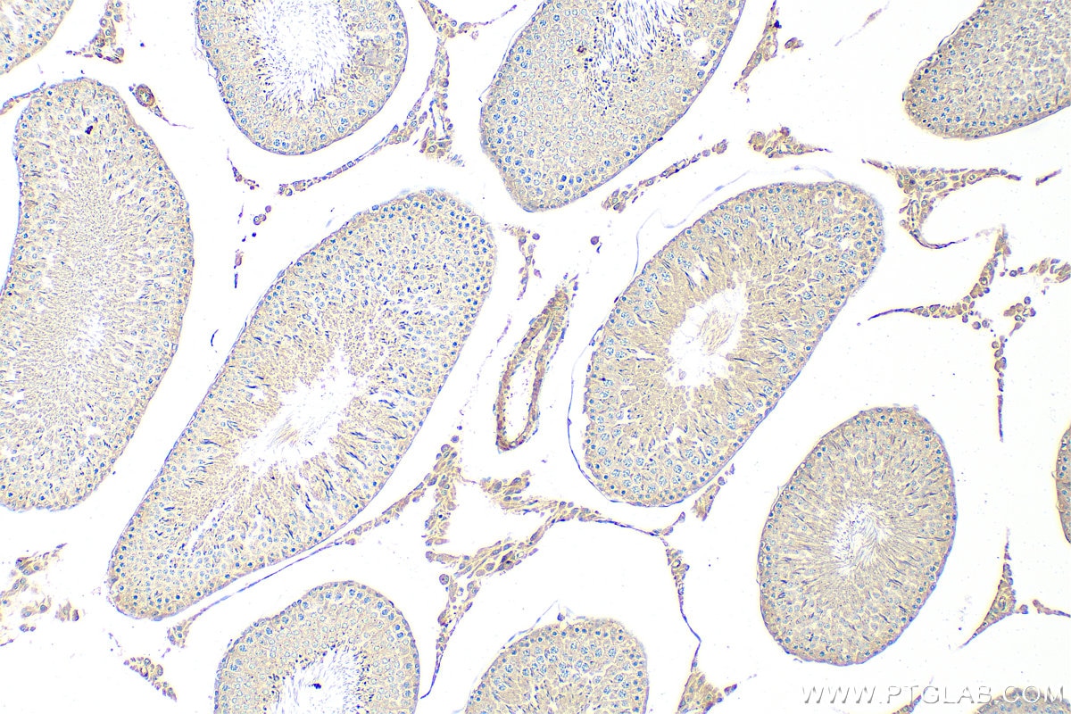 Immunohistochemistry (IHC) staining of rat testis tissue using BRCA1 Polyclonal antibody (22362-1-AP)