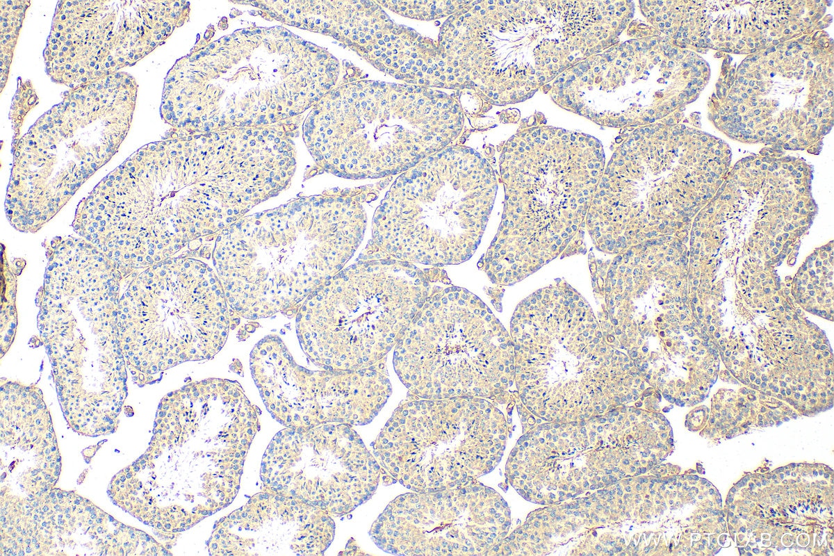 Immunohistochemistry (IHC) staining of mouse testis tissue using BRCA1 Polyclonal antibody (22362-1-AP)