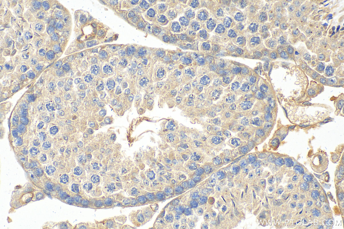 Immunohistochemistry (IHC) staining of mouse testis tissue using BRCA1 Polyclonal antibody (22362-1-AP)