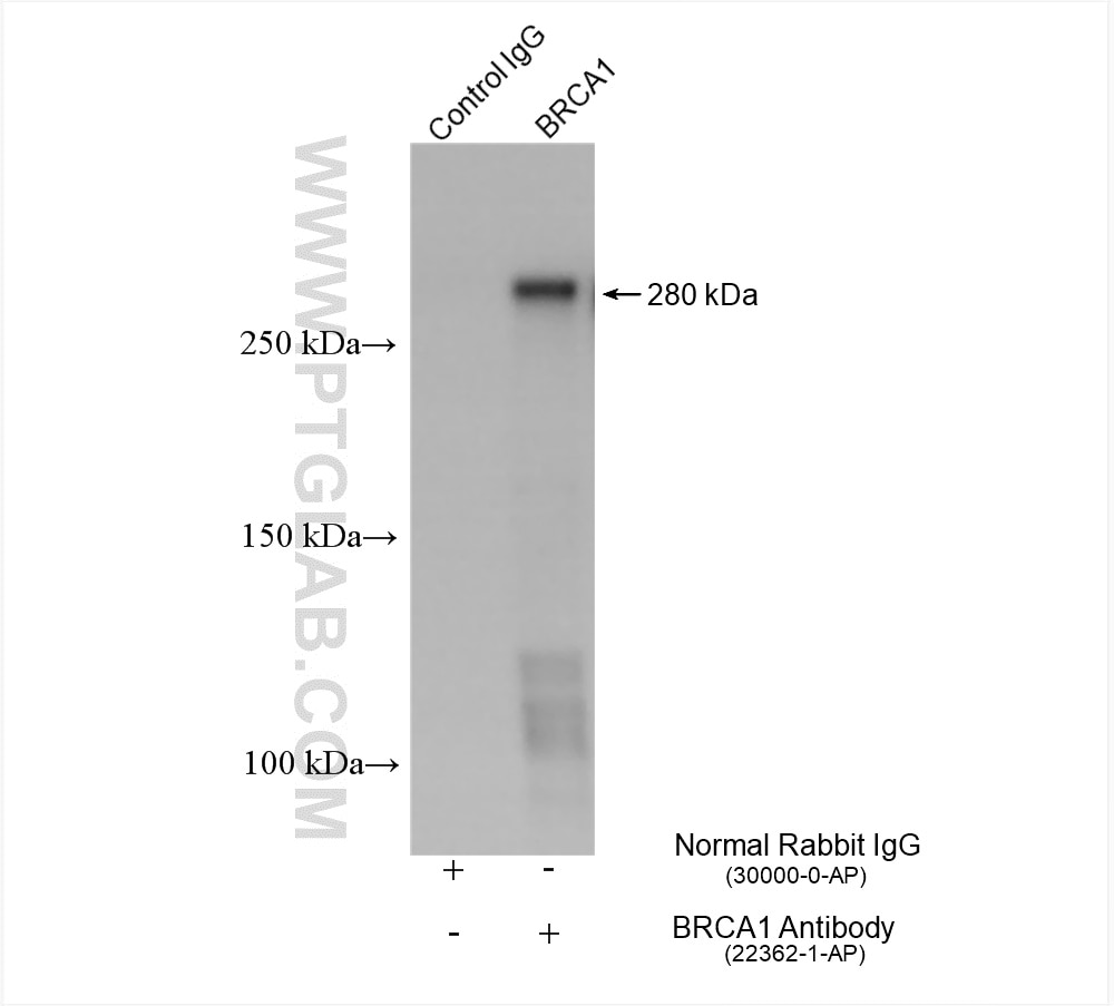 Immunoprecipitation (IP) experiment of MCF-7 cells using BRCA1 Polyclonal antibody (22362-1-AP)