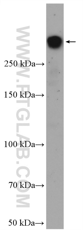 Western Blot (WB) analysis of MCF-7 cells using BRCA1 Polyclonal antibody (22362-1-AP)