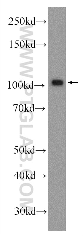 BRCA1 Polyclonal antibody